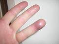 Thumb 6